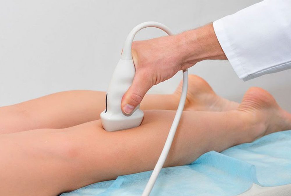 Médico realizando exame de ultrassom Doppler na perna da paciente
